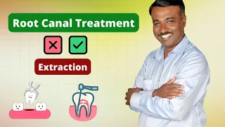 Root Canal Treatment Or Tooth Extraction - Which One Is Better