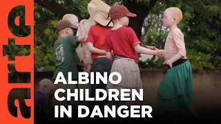 Tanzania: Albinos' Stolen Childhood | ARTE.tv Documentary