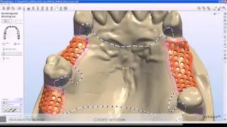 3D моделирование зубной челюсти