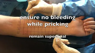 Skin prick tests