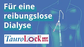 TauroLock™-HEP500 in der Dialyse