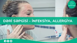 Rəvan saat - Dəri səpgisi  - infeksiya, allergiya