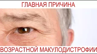 Причина возрастной макулодистрофии. Центр Ока