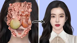 ASMR Remove Big Acne & Worm Infected Dirty Face | Deep Cleaning Animation