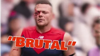 AFL’S Most HORRIBLE Injuries!