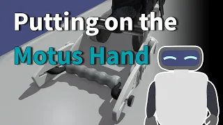 How to put on the Motus Hand - Severe Contracture Grip - Right Hand - Part 7