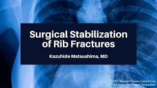 Surgical Stabilization of Rib Fractures | The USC Trauma Course