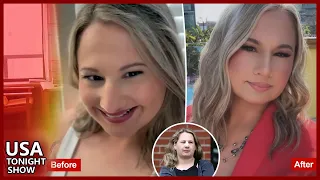Gypsy Rose Blanchard Shows Off Her New Look After Undergoing a Nose Job