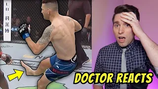 Doctor Reacts to Chris Weidman Shattered BROKEN Leg at UFC 261