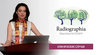 Ирина Трофименко. Когда звонит нейрохирург - подборка случаев