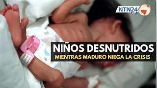 Así luchan por su vida los niños desnutridos en Venezuela mientras Maduro niega la crisis