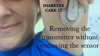 Removing the transmitter without removing the sensor. Dexcom G6 and One