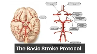 The basic stroke protocol in the emergency department