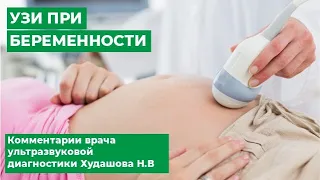 УЗИ при беременности. Комментарии врача ультразвуковой диагностики Худашова Н.В (МЦ МИРТ)