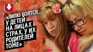 У моей дочери заячья губа, волчья пасть и пороки развития: Елена |Быть мамой