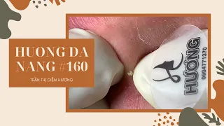 #160 | Huong Da Nang