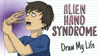 ALIEN HAND SYNDROME | Draw My Life