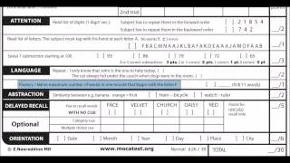 Administration of the Montreal Cognitive Assessment