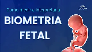 Webinar CAPDIM - Biometria Fetal