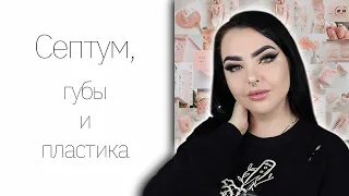 Я сделала губы? Немного про пластику.