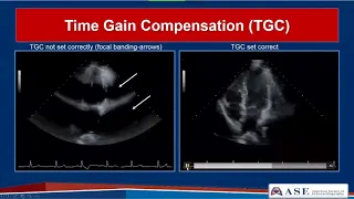 ASE Guidelines for Performing a Comprehensive Echo  in Adults Part 1