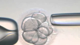 Procedimentos de Fertilização in vitro - Vídeo Completo