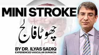 1st Time In The History Janiye Mini Stroke (Chotay Falij) Ka Faida! Dr. Ilyas Sadiq Vascular Surgeon