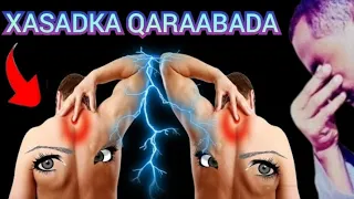 Xasadka Qaraabada|| Subxanallah || Fiiri Calamadihiisa & Dawadiisa|| Sh.Bacadle