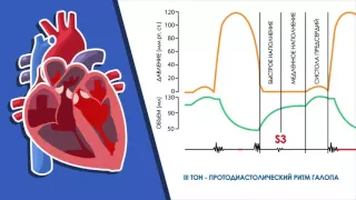Аускультация сердца. Дополнительные тоны