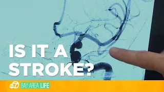 How to tell if you are having a stroke