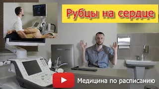 "Рубцы на сердце" после инфаркта миокарда