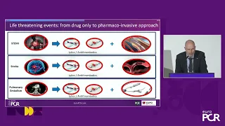 Why mechanical thrombectomy should be considered in the management of acute pulmonary embolism