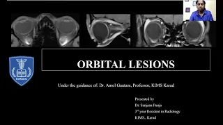 Sanjana Punja || MRI IN ORBITAL LESIONS