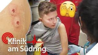 Komische Pusteln: Was für eine seltene Krankheit hat Tobias (12)? 😳 | Klinik am Südring | SAT.1