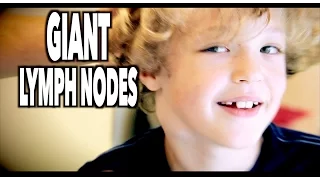 GIANT LYMPH NODES, Sore Throat, & 1 Really Cute Kid | Dr. Paul