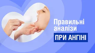 Чи потрібні антибіотики при ангіні? - експертна думка лор-хірурга | Правильні аналізи при ангіні