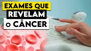 Estes 9 EXAMES mostram se você pode ter CÂNCER em algum órgão! │ Médico Explica