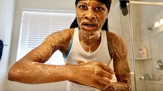 DISGUSTING SKIN PRANK ON AR'MON AND TREY!!!