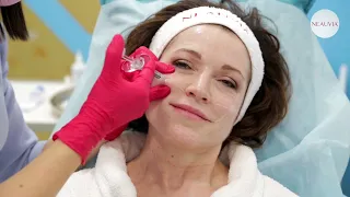 Коррекция Stimulate Man, биоревитализация лица, шеи и рук, Hydro DeLuxe, актрисе Алене Хмельницкой
