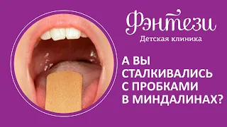 А вы сталкивались с пробками в миндалинах?😱Отоларинголог Некрасова Наталия #детскаяклиникамосква