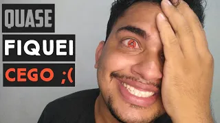 LENTES SHARINGAN DA SHOPEE - UNBOXING