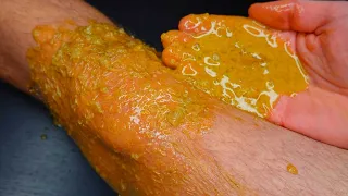 This GOLDEN OINTMENT QUICKLY WILL REMOVE ALL PAIN FROM KNEES, JOINTS, BACK, FROM INJURIES!!!