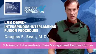 LAB DEMO: Interspinous Interlaminar Fusion- Douglas P Beall, M.D.