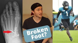 Lisfranc Injuries in the NFL | Travis Etienne's Foot