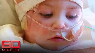 Sophie Delezio survives horror daycare car crash | 60 Minutes Australia