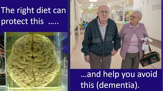 Reversing dementia with diet- a 2021 update - Dr Paul Mason