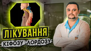 Лікування Лордозу та Кіфозу. Синдром плоскої спини