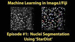 Machine Learning in ImageJ/Fiji - StarDist