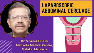 Laparoscopic abdominal cerclage