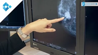 Brustdiagnostik - Knoten frühzeitig erkennen